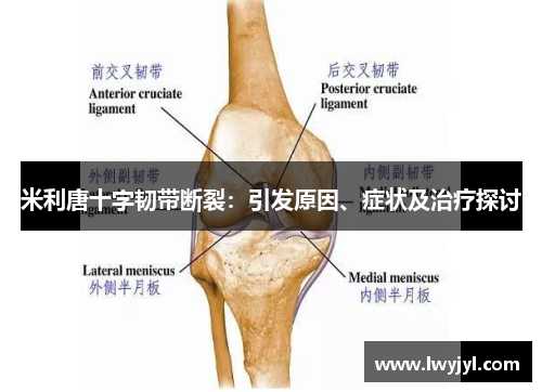 米利唐十字韧带断裂：引发原因、症状及治疗探讨